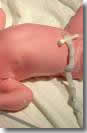 Baby attached to umbilical cord